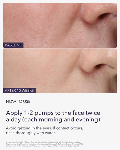 ALASTIN Skincare Restorative Skin Complex Anti - Aging Face Serum (1 oz) | Reduce Fine Lines & Wrinkles | With Niacinamide to Improve Texture - Wholesale Rabbits