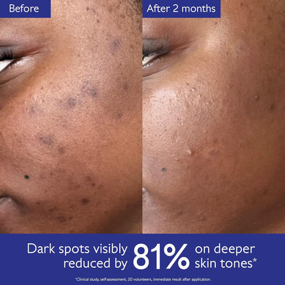 Caudalie Vinoperfect Brightening Dark Spot Serum Vitamin C Alternative - 62x More Effective than Vitamin C with Viniferine for a Visibly Brighter Even Complexion - Wholesale Rabbits