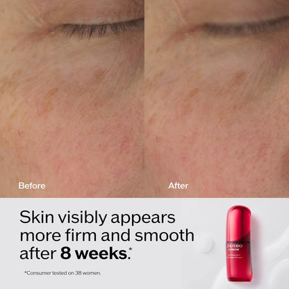 Shiseido Ultimune Power Infusing Serum - Breakthrough Lightweight Face Serum - Boosts Radiance & Improves Visible Signs of Aging - All Skin Types - Non - Comedogenic - Wholesale Rabbits